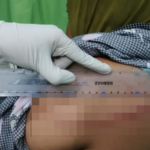 Cekcok Mulut Berujung Kekerasan, Oknum PNS di Lape Aniaya Dua IRT dengan Parang