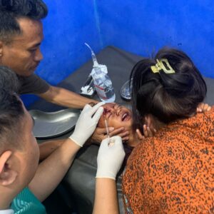 ANAK 3 TAHUN DISERANG DAN DIGIGIT ANJING DIDUGA RABIES DI MANGGELEWA, POLISI IMBAU WARGA WASPADA